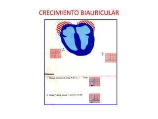 CRECIMIENTO BIAURICULAR
 