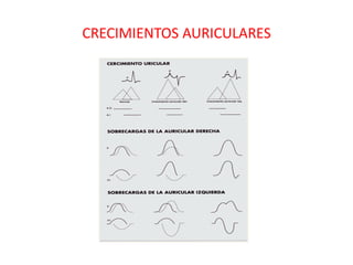 CRECIMIENTOS AURICULARES
 