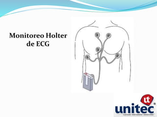 Monitoreo Holter
de ECG
 