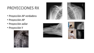 ANATOMIA DEL HOMBRO..................... | PPTX