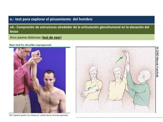 e.- test para explorar el pinzamiento del hombro
e4.- Compresión de estructuras alrededor de la articulación glenohumeral en la elevación del
brazo
Arco pasivo doloroso (test de neer)
 