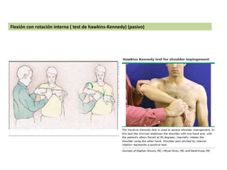 Flexión con rotación interna ( test de hawkins-Kennedy) (pasivo)
 