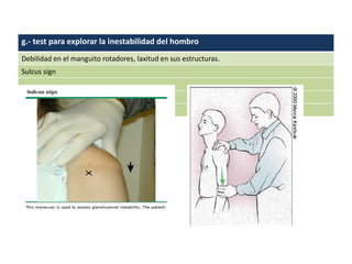 g.- test para explorar la inestabilidad del hombro
Debilidad en el manguito rotadores, laxitud en sus estructuras.
Sulcus sign
 