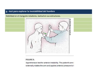 g.- test para explorar la inestabilidad del hombro
Debilidad en el manguito rotadores, laxitud en sus estructuras.
 
