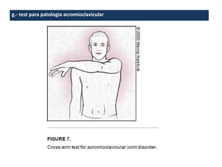 g.- test para patologia acromioclavicular
 