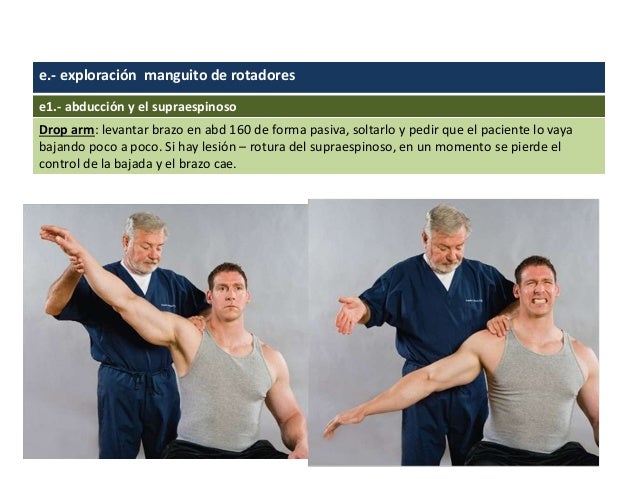 Exploración Física del Hombro