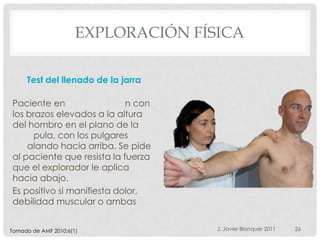 EXPLORACIÓN FÍSICA

     Test del llenado de la jarra

Paciente en                 n con
los brazos elevados a la altura
del hombro en el plano de la
      pula, con los pulgares
    alando hacia arriba. Se pide
al paciente que resista la fuerza
que el explorador le aplica
hacia abajo.
Es positivo si manifiesta dolor,
debilidad muscular o ambas


Tomado de AMF 2010;6(1)              J. Javier Blanquer 2011   26
 