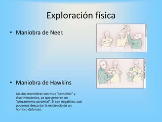 • Maniobra de Neer.
• Maniobra de Hawkins
Las dos maniobras son muy “sensibles” y
discriminatorias, ya que generan un
“pinzamiento acromial”. Si son negativas, casi
podemos descartar la existencia de un
hombro doloroso.
Exploración física
 