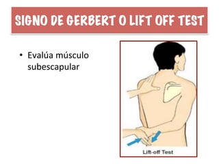 SIGNO DE GERBERT O LIFT OFF TEST
•  Evalúa	
  músculo	
  
subescapular	
  
 