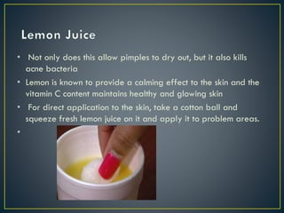 • Not only does this allow pimples to dry out, but it also kills
acne bacteria
• Lemon is known to provide a calming effect to the skin and the
vitamin C content maintains healthy and glowing skin
• For direct application to the skin, take a cotton ball and
squeeze fresh lemon juice on it and apply it to problem areas.
•
 