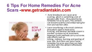 6 Tips For Home Remedies For Acne
Scars -www.getradiantskin.com
• Acne breakouts can cause acne
scarring, which is something a lot of
people suffer from - they need home
remedies for acne scars. This ailment
can become painful and embarrasing for
men and women alike.
• Laser resurfacing is the most common
procedure used to treat acne
scarring, and benzoyl peroxide cream is
another common acne treatment.
However, both methods carry out some
side effects such as
itching, redness, burning and peeling of
your skin. But there are some home
remedies for acne scars that can help
you deal with this ailment effectively
and naturally.
 