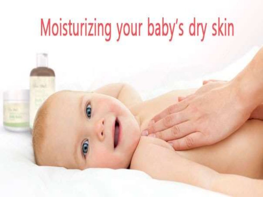 Top Homemade Dry Skin Remedies for Babies