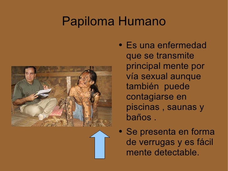 El bigote de oro del tratamiento de la psoriasis