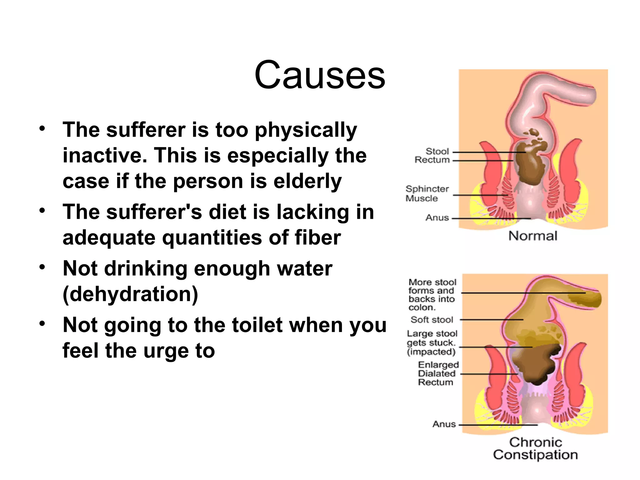 Causes
• The sufferer is too physically
  inactive. This is especially the
  case if the person is elderly
• The sufferer's diet is lacking in
  adequate quantities of fiber
• Not drinking enough water
  (dehydration)
• Not going to the toilet when you
  feel the urge to
 