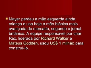  Mayer perdeu a mão esquerda ainda
 criança e usa hoje a mão biônica mais
 avançada do mercado, segundo o jornal
 britânico. A equipe responsável por criar
 Rex, liderada por Richard Walker e
 Mateus Godden, usou US$ 1 milhão para
 construí-lo.
 