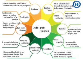 Homeopathic medicine for joint pains