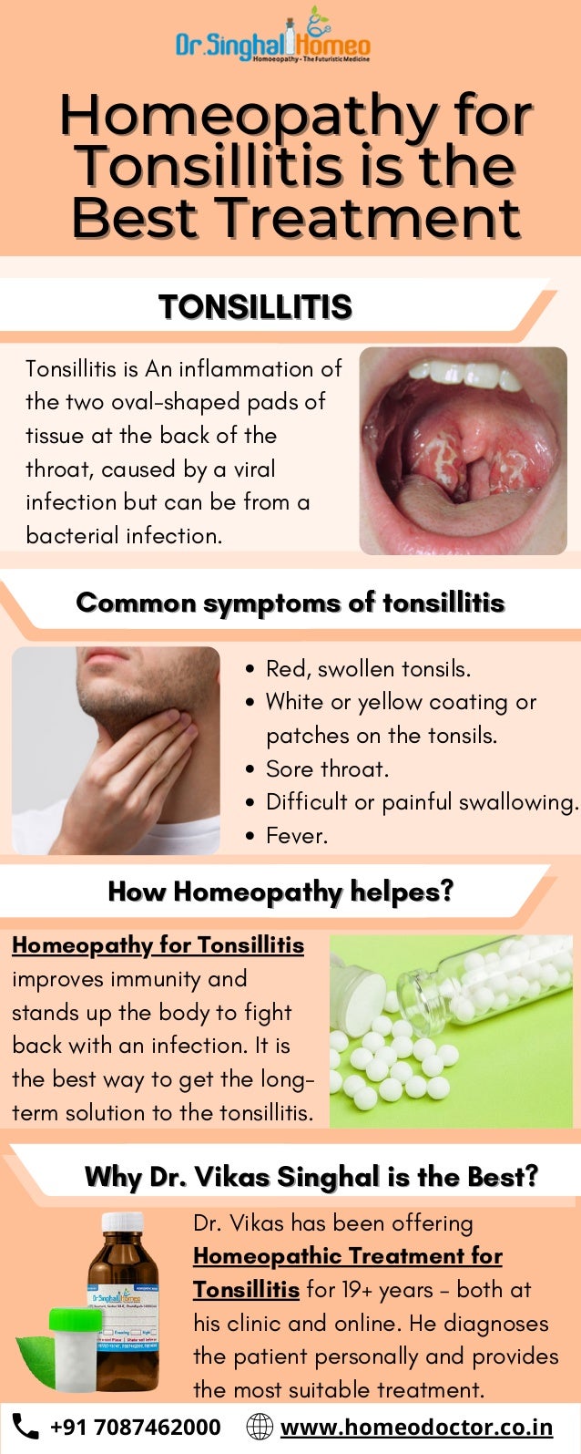 Homeopathy for tonsillitis is the best treatment