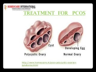 TREATMENT FOR PCOS

http://www.homeocare.in/pcos-polycystic-ovariansyndrome.html

 