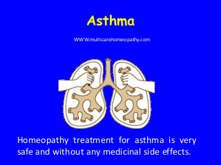 Homeopathy treatment for asthma is very
safe and without any medicinal side effects.
WWW.multicarehomeopathy.com
 