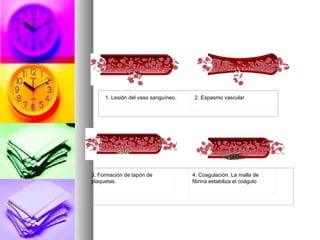 1. Lesión del vaso sanguíneo.    2. Espasmo vascular




3. Formación de tapón de             4. Coagulación. La malla de
plaquetas.                           fibrina estabiliza el coágulo
 