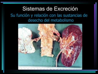 Sistemas de Excreción Su función y relación con las sustancias de desecho del metabolismo 