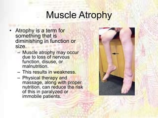 Muscle Atrophy
• Atrophy is a term for
something that is
diminishing in function or
size.
– Muscle atrophy may occur
due to loss of nervous
function, disuse, or
malnutrition.
– This results in weakness.
– Physical therapy and
massage, along with proper
nutrition, can reduce the risk
of this in paralyzed or
immobile patients.
 