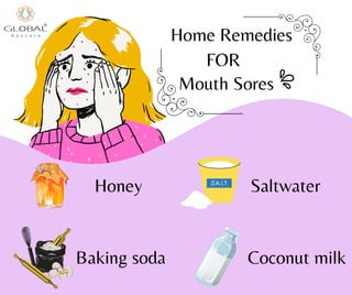 FOR
Mouth Sores
Home Remedies
Honey Saltwater
Baking soda Coconut milk
 
