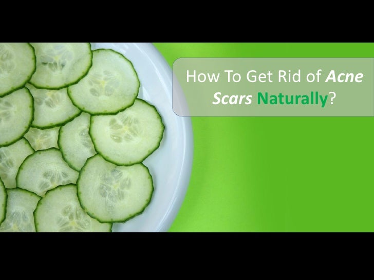 How To Get Rid Of Back Acne Scars Naturally How To Get Rid Of Back Acne Scars Naturally