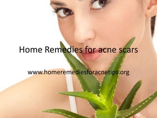 Home Remedies for acne scars

  www.homeremediesforacnetips.org
 