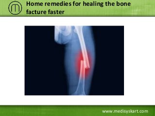 www.medisyskart.com
Home remedies for healing the bone
facture faster
 