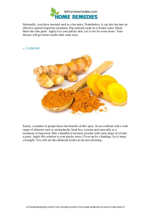 Home remedies for ringworm