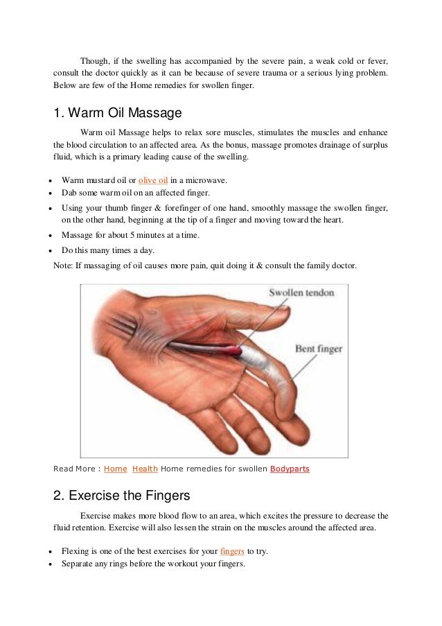 Home remedies for swollen finger