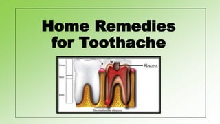 Home Remedies
for Toothache
 