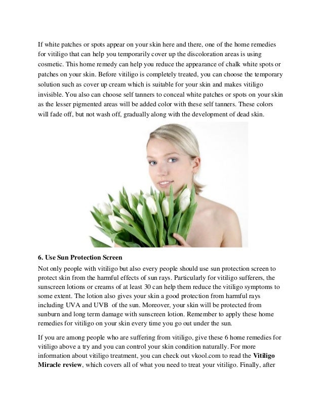 6 Home Remedies For Vitiligo – Cure Vitiligo Naturally!