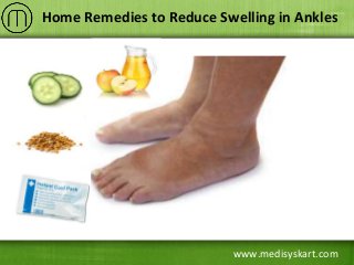 www.medisyskart.com
Home Remedies to Reduce Swelling in Ankles
 