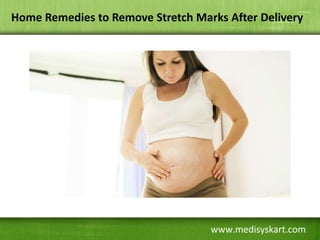 www.medisyskart.com
Home Remedies to Remove Stretch Marks After Delivery
 