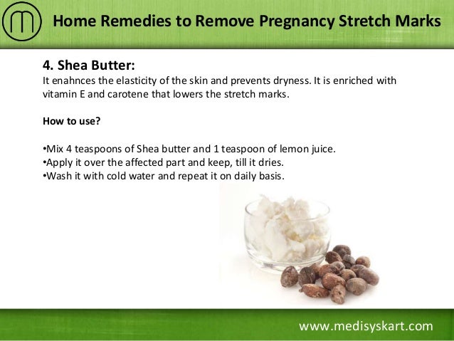 itchy stretch marks home remedy