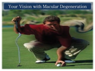 Your Vision with Macular Degeneration
 