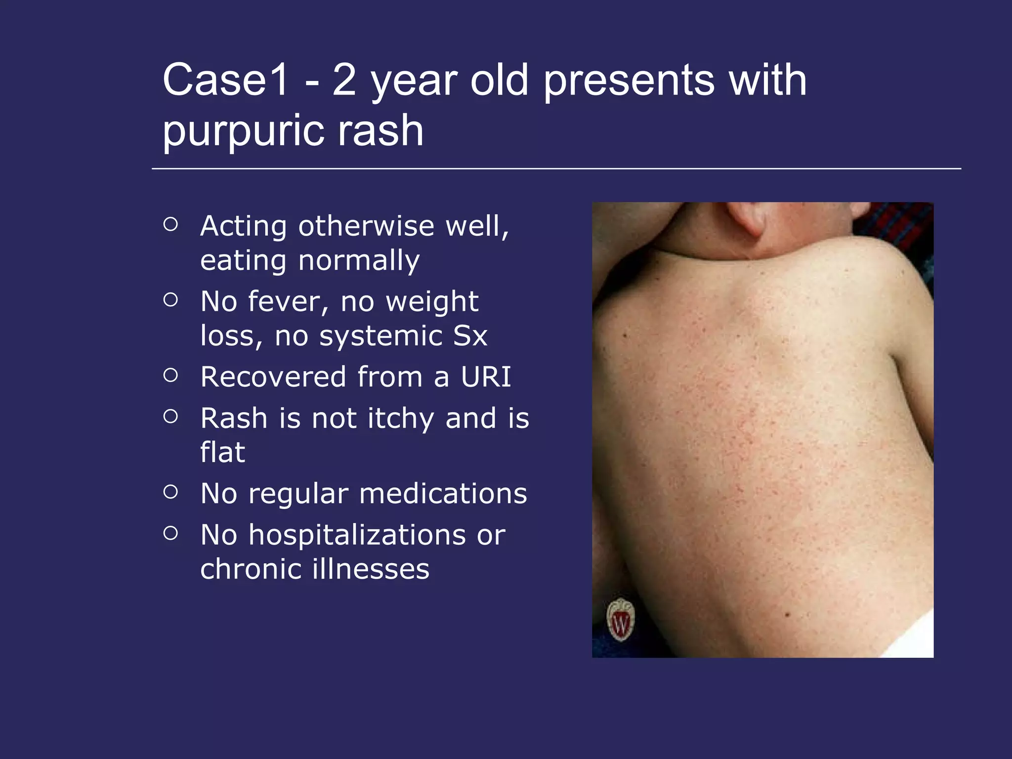 Case1 - 2 year old presents with purpuric rash Acting otherwise well, eating normally No fever, no weight loss, no systemic Sx Recovered from a URI  Rash is not itchy and is flat No regular medications No hospitalizations or chronic illnesses 