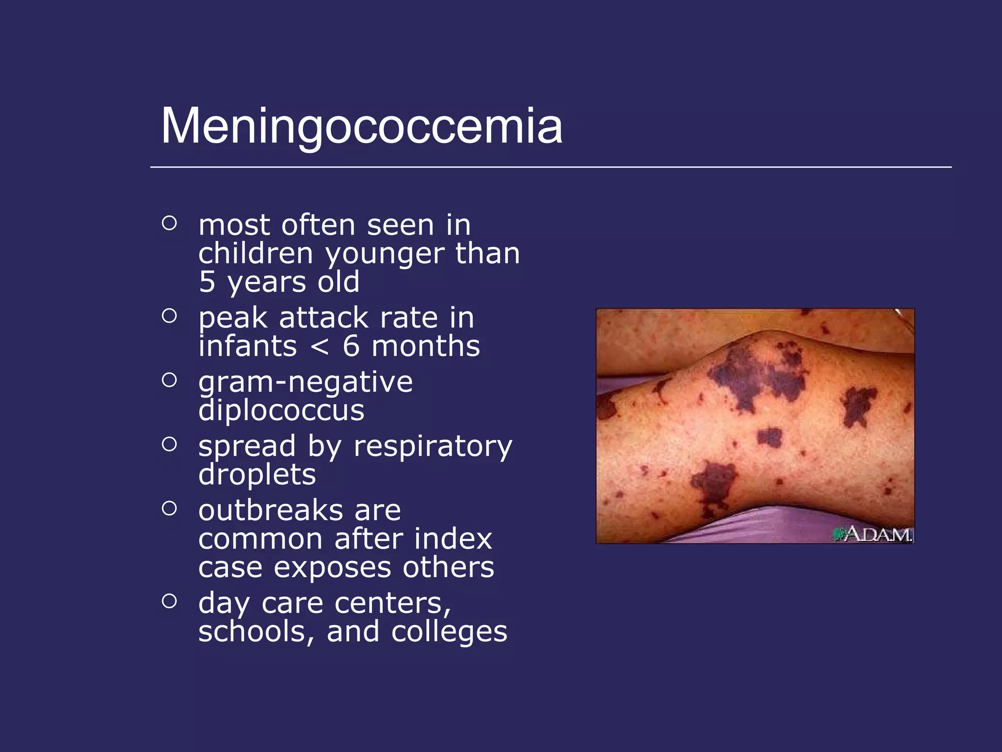 Meningococcemia most often seen in children younger than 5 years old peak attack rate in infants < 6 months gram-negative diplococcus spread by respiratory droplets outbreaks are common after index case exposes others day care centers, schools, and colleges 