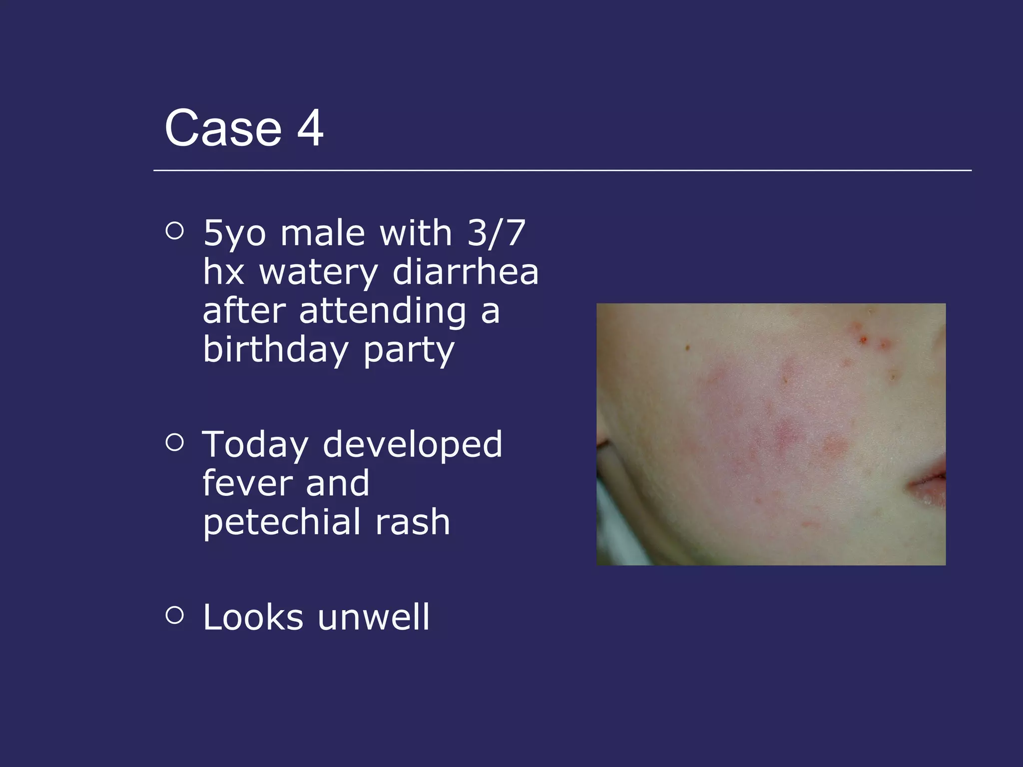 Case 4 5yo male with 3/7 hx watery diarrhea after attending a birthday party Today developed fever and  petechial rash Looks unwell 