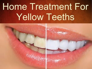 Home Treatment For 
Yellow Teeths 
 