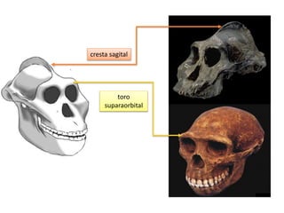 cresta sagital
toro
suparaorbital
 