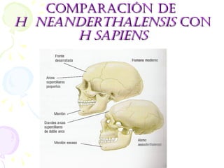 COMPARACIÓN DE  H  neanderthalensis  CON  H sapiens 