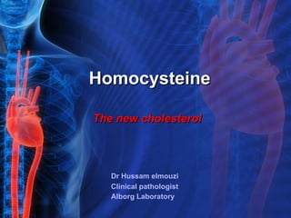 Homocysteine Dr Hussam elmouzi  Clinical pathologist  Alborg Laboratory The new cholesterol 