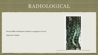 RADIOLOGICAL
Previous MRI of lumbosacral vertebrae was suggestive of severe
degenerative changes
 
