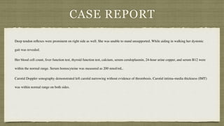 CASE REPORT
Deep tendon re
fl
exes were prominent on right side as well. She was unable to stand unsupported. While aiding in walking her dystonic
gait was revealed.
 

Her blood cell count, liver function test, thyroid function test, calcium, serum ceruloplasmin, 24-hour urine copper, and serum B12 were
within the normal range. Serum homocyteine was measured as 200 nmol/mL.
 

Carotid Doppler sonography demonstrated left carotid narrowing without evidence of thrombosis. Carotid intima–media thickness (IMT)
was within normal range on both sides.
 