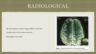 RADIOLOGICAL
Her brain magnetic resonance imaging (MRI) revealed deep
watershed infarct in left centrum semiovale
.

Basal ganglia were normal.
 