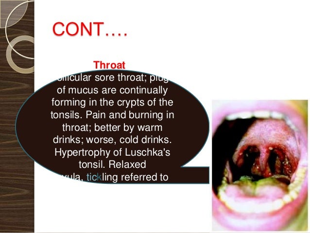 Jaw Pain After Eating Hard Food Jaw Pain After Eating Hard Food