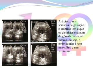 Até cinco, seis
semanas de gestação
o embrião tem o que
os cientistas chamam
de gônada bissexual
interna, ou seja, o
embrião não é nem
masculino e nem
feminino.
 